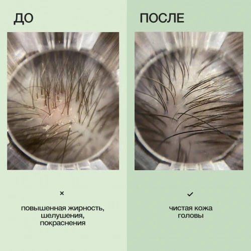 LIMBA COSMETICS Шампунь для волос (Detox)